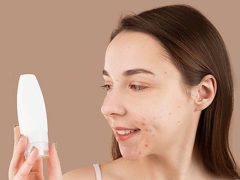 Suffering from hormonal acne? Make changes to your lifestyle to regulate the imbalance, say experts.