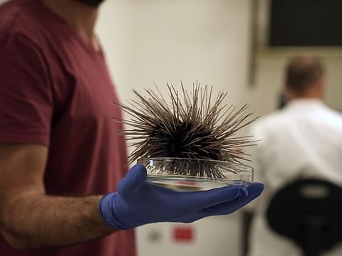 A scientist holds a sea urchin specimen of the long-spined Diadema setosum, found in the Mediterranean, at the Steinhardt Museum of Natural History of Tel Aviv University in Tel Aviv, Israel, Wednesday, May 24, 2023.