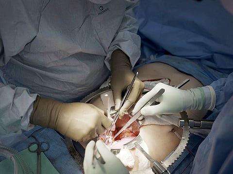 File photo: Surgeons at NYU Langone Health prepare to transplant a pig's kidney into a brain-dead man in New York on July 14, 2023. Researchers around the country are racing to learn how to use animal organs to save human lives.