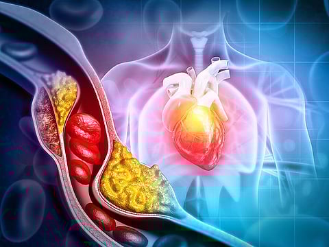 High levels of Lipoprotein(a), is similar to LDL cholesterol, sometimes called ‘bad cholesterol’, but is more sticky, increasing risk of blockages and blood clots in arteries.