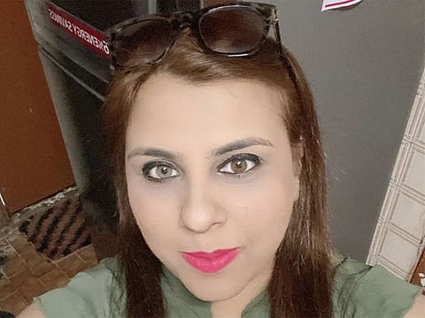 Shumaila Jacquiline William, 42, has a rare eye condition called Heterochromia where the eyes are of two different colours. Her right eye is brown and the left green.