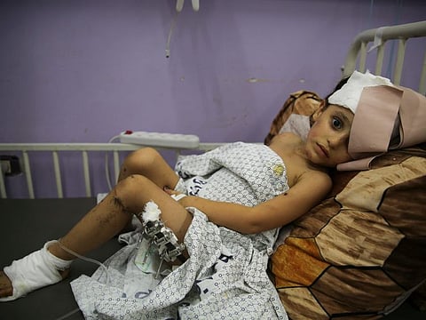 Kenzi Al Madhoun, a four-year-old who was wounded in Israeli bombardment, lies at Al Aqsa Hospital in Deir Al Balah City, Gaza Strip, on  November 1, 2023.