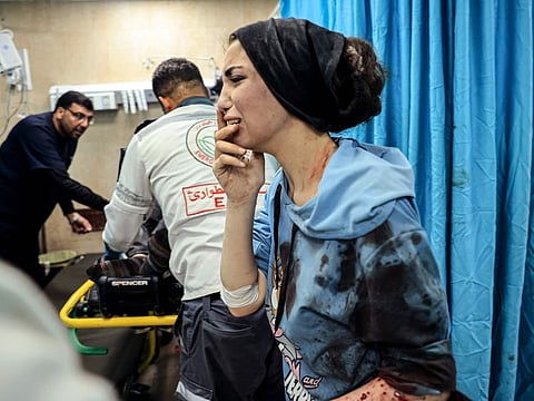 An injured Palestinian woman reacts as she stands in the emergency room of the Al Aqsa Hospital following the Israeli bombardment of Deir El Balah, in the central Gaza Strip on November 15, 2023, amid the ongoing battles between Israel and the Palestinian group Hamas.