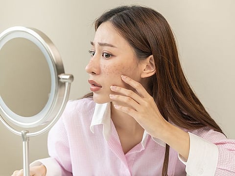 It can be tempting to squeeze or pick at pimples, but this can lead to inflammation, scarring, and even infections.