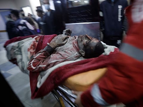 A wounded Palestinian man is wheeled into the Nasser Hospital following an Israeli bombardment on Khan Younis refugee camp, southern Gaza Strip.