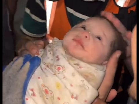 The baby survived against all odds.