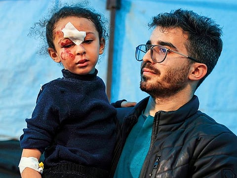 A child injured during Israeli bombardment receives treatment at the Kuwait Hospital in Rafah in the southern Gaza Strip on December 20, 2023, amid ongoing battles between Israel and the Palestinian militant group Hamas.