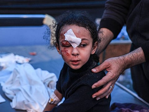 A child injured during Israeli bombardment receives treatment at the Kuwait Hospital in Rafah in the southern Gaza Strip on December 20, 2023.
