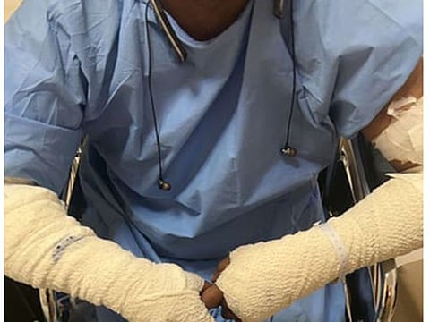 The injured Saudi man in a Tabuk hospital.