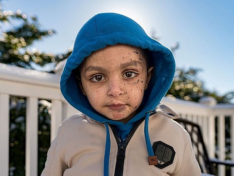 Omar was brought out of Gaza and to the United States, where he received treatment.