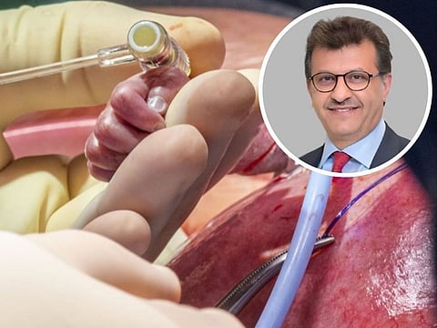 Dr Hani Najm has led a team that performed a complex life-saving surgery to remove a heart tumour in a 26-week-old foetus. “In some parts of the world a heart transplant is not even a viable option for care. We hope this novel approach will not only prevent the need for transplant but may also improve longer-term outcomes in patients with right ventricle-dependent coronary circulation.”