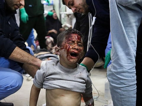 Palestinians wounded in the Israeli bombardment are being treated at a hospital in Rafah on Sunday, March 24, 2024.