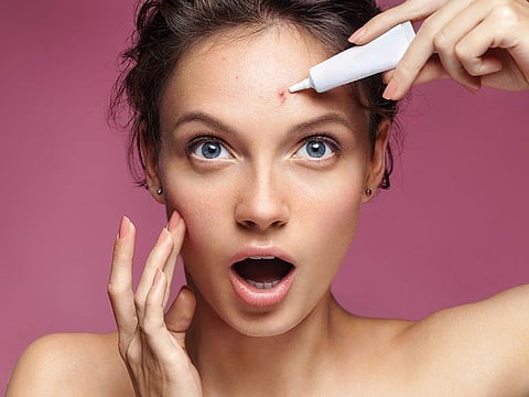 Managing acne-prone skin can be a challenge, but a well-developed skincare regimen can keep breakouts under control.