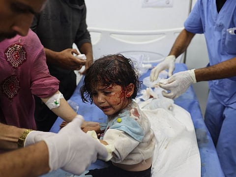 A Palestnian girl, wounded in an Israeli strike on a camp for displaced Gazans, receives treatment at a hospital in Rafah on May 26, 2024.