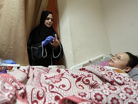 Hanan Akel, who suffered burn injuries in an Israeli strike, lies on a bed at Al Aqsa Martyrs Hospital.