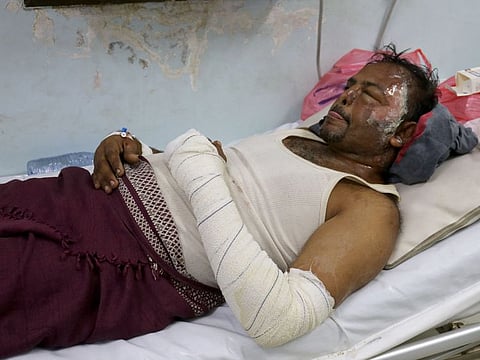 A man injured in an Israeli strike in Yemen's Houthi-held port city of Hodeida, lies in a hospital bed on July 20, 2024.