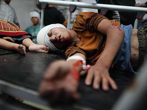 Palestinians are treated at the Nasser hospital, where the injured and dead arrive following the Israeli targeting the southeastern district of Khan Younis, in the southern Gaza Strip, on July 25, 2024.