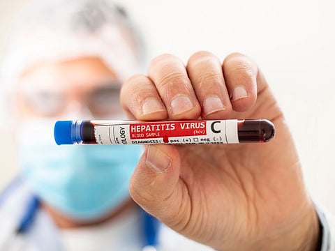 HCV examination for early diagnosis is important to reduce its transmission to others.