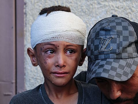 An injured child cries in the yard of the Al-Aqsa Martyrs hospital in Deir el-Balah in the central Gaza Strip, following an overnight Israeli strike on August 10, 2024, amid the ongoing conflict between Israel and the Palestinian Hamas movement