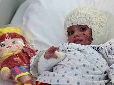 Two-year-old Ivana Skayki who suffred burns from an Israeli strike in southern Lebanon, rests in bed at Geitaoui Hospital in Beirut on October 30, 2024.