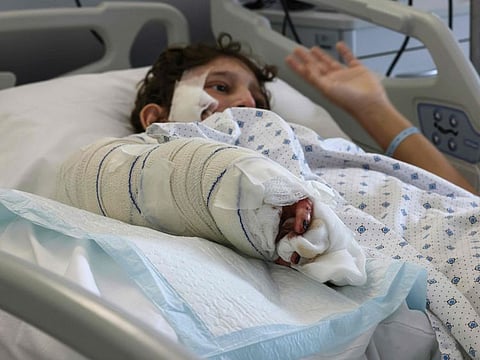 Injured boy Mohammed Ibrahim who suffered burns following an Israeli strike in southern Lebanon, rests at Geitaoui Hospital in Beirut on October 30, 2024.