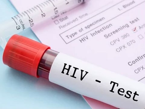 More than a million people globally acquire a new HIV infection each year