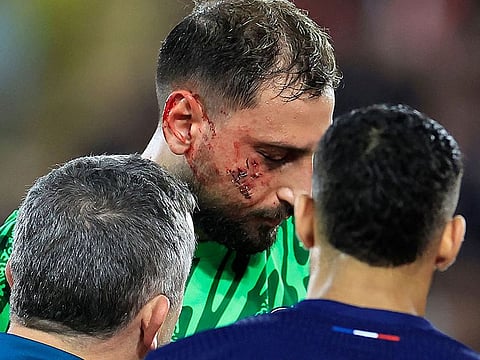 Paris Saint-Germain goalkeeper Gianluigi Donnarumma (centre) receives medical help after sustaining an injury during the French L1 match against AS Monaco on Wednesday.