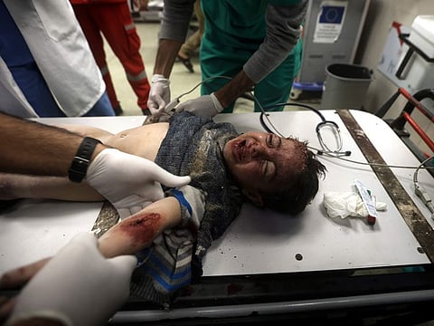 A Palestinian child wounded in the Israeli bombardment of the Gaza Strip receives treatment at the Nasser hospital in Khan Younis, southern Gaza Strip.
