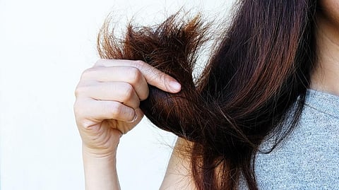 Medical term of the week: Trichophagia