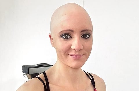 Victoria says having no hair is a part of who
she is now…