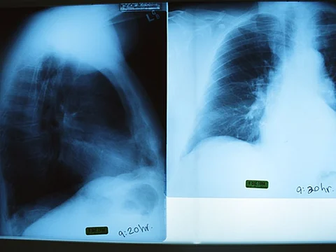 xray pictures
