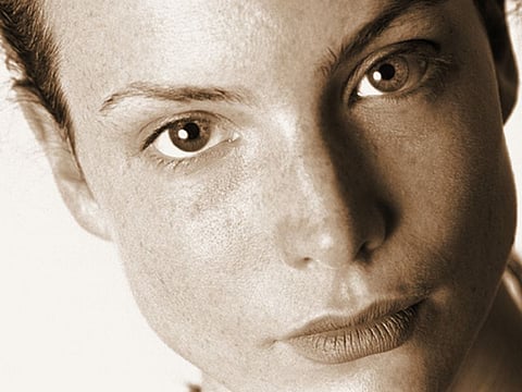 Raspberry Pi-Based System Accurate for Detecting Facial Palsy