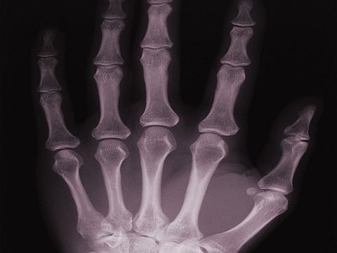 hand x-ray