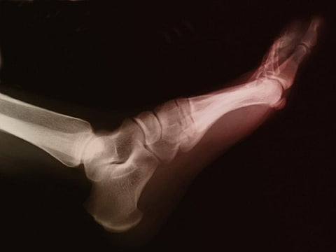 foot x-ray