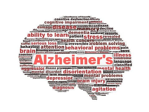 alzheimer\'s disease