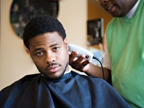Barbers Can Partner With Dermatologists to Augment Pseudofolliculitis Barbae Care