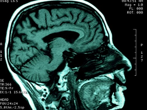 brain