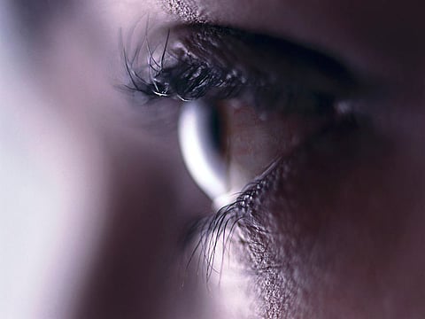 Eye's 'Microbiome' Could Give Clues to Better Dry Eye Treatments
