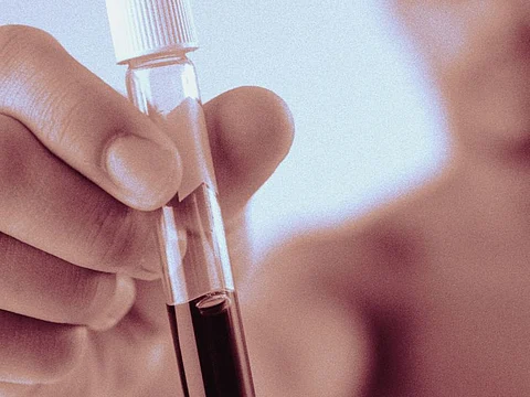 blood specimen