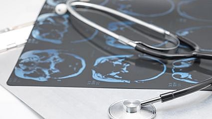 La fototerapia podría ayudar a sanar  cerebros lesionados