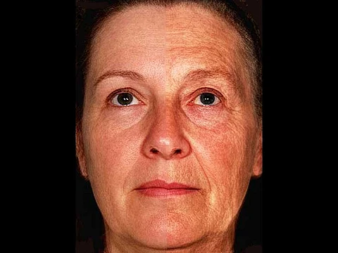 aging face composite