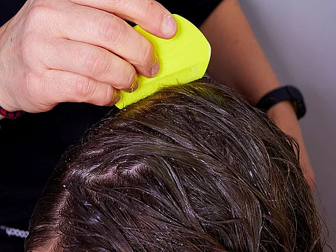checking for lice