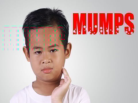 mumps