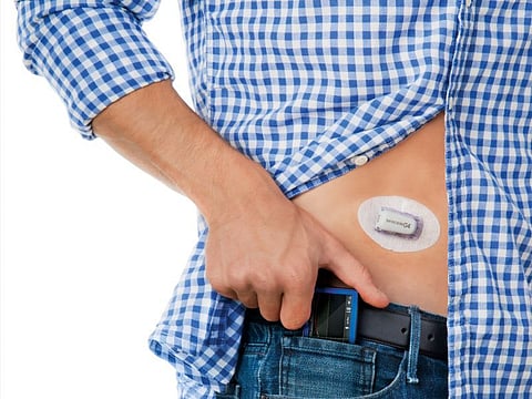 continuous glucose monitor