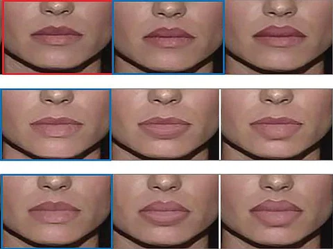augmented lips
