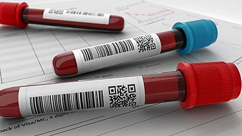 Los científicos descubren por qué el grupo sanguíneo podría ser importante en la infección con la COVID