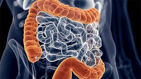 People's 'Microbiomes' Might Influence COVID-19 Severity: Study