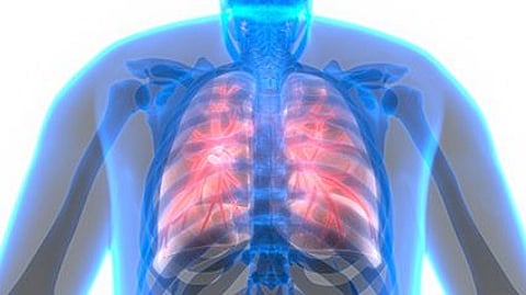 respiratory disease