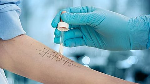 CDC Reports on Prevalence of Seasonal and Food Allergies, Eczema