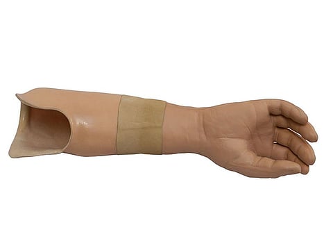 prosthetic arm